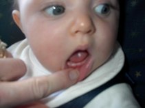 03-05 (FirstTeeth)