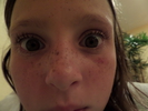 SAM 0015